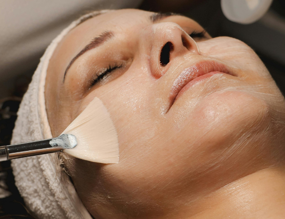 Chemical Peels