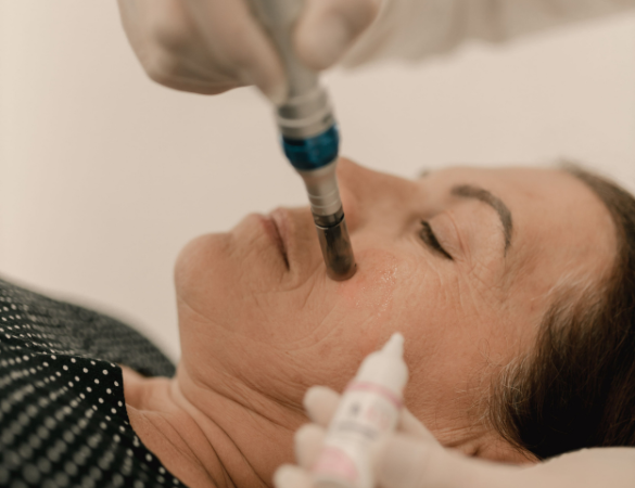 Full Face Rejuvenation