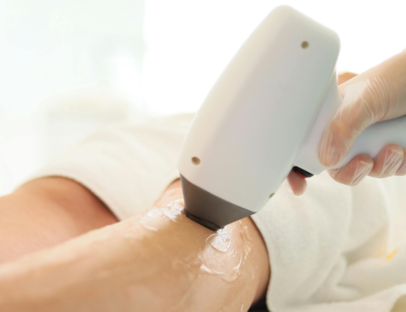 Laser Hair Removal Pontefract aesthetics clinic