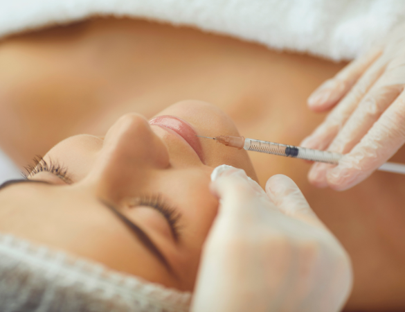 Lip Filler