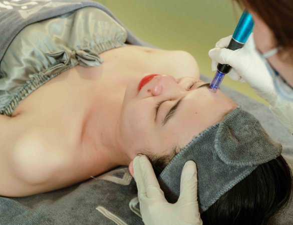 PRP Microneedling