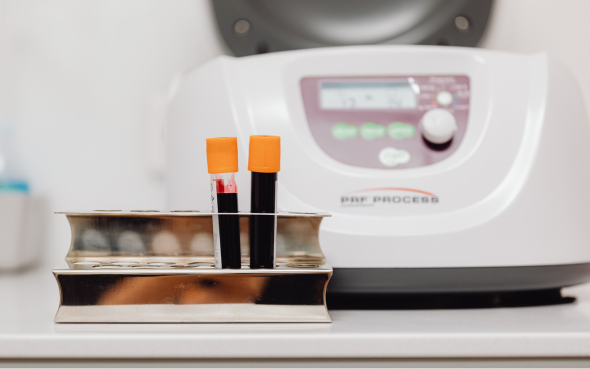 PRP Microneedling skin clinic in Pontefract Leeds Wakefield Pontefract