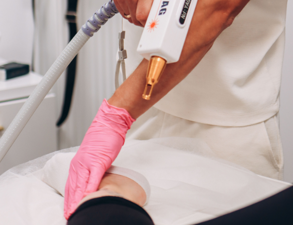 Tattoo Removal Pontefract aesthetics clinic