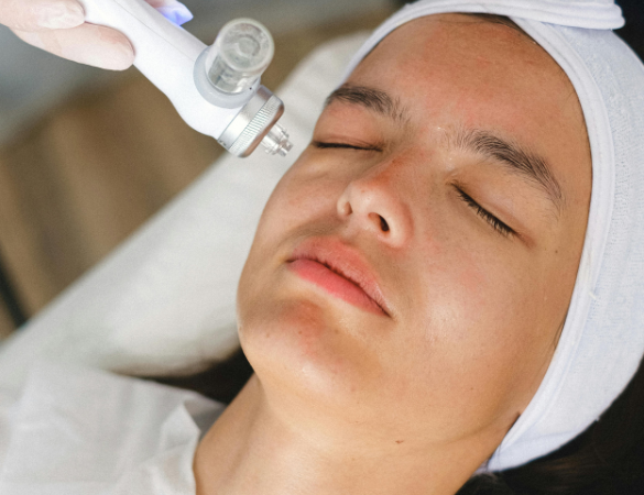 Thulium Laser Skin Rejuvenation Pontefract aesthetics clinic